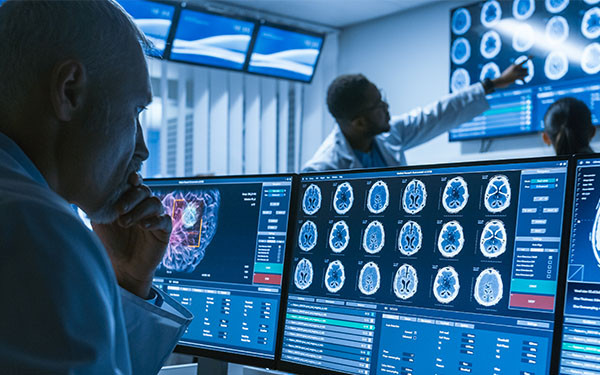 Over-the-shoulder shot of medical scientist and neurologists looking at CT brain scans on laboratory computers